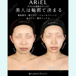 症例