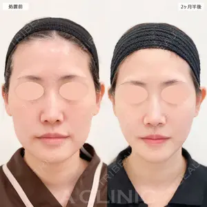 症例