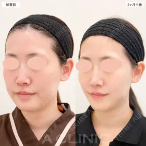 症例