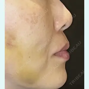 症例