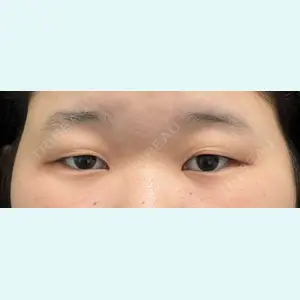 症例