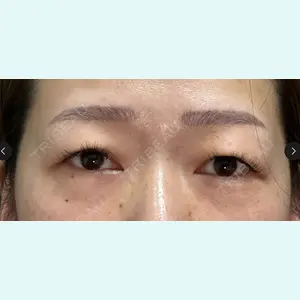 症例