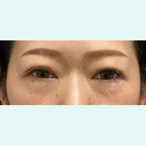症例