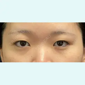 症例