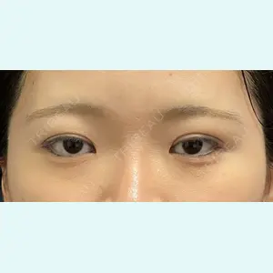 症例