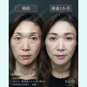 ROOTS Clinic 郭 天元医師の症例