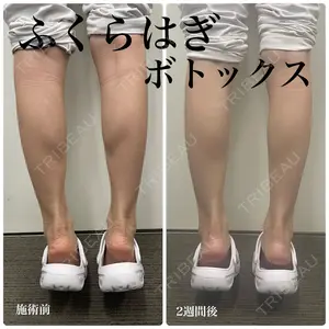 春山記念病院 山田 浩之医師の症例