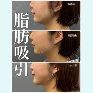 春山記念病院 山田 浩之医師の症例