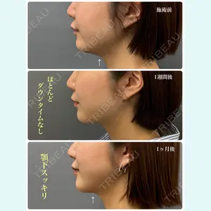 春山記念病院 山田 浩之医師の症例