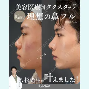症例