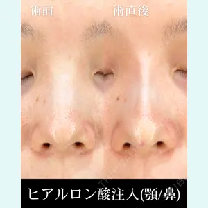 症例