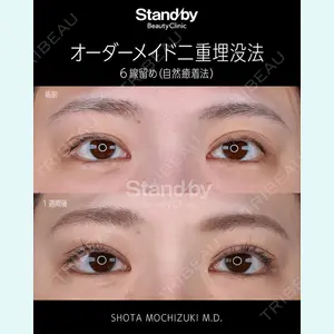 Stand by Beauty Clinic 望月 聖太医師の症例