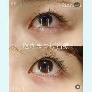 BIANCA銀座 服部 有美医師の症例