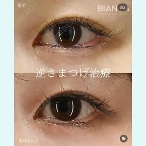 BIANCA銀座 服部 有美医師の症例