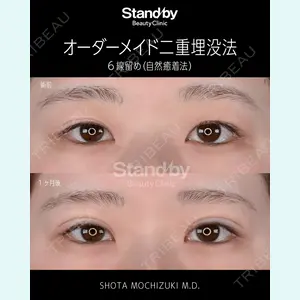 Stand by Beauty Clinic 望月 聖太医師の症例