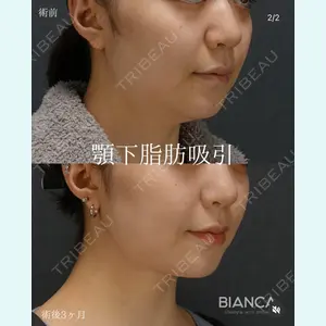BIANCA銀座 服部 有美医師の症例