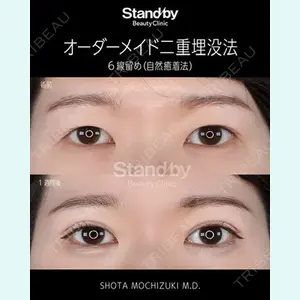 Stand by Beauty Clinic 望月 聖太医師の症例