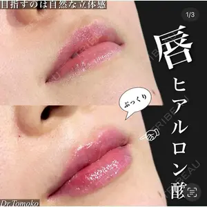 BIANCA表参道 松田 朋子医師の症例