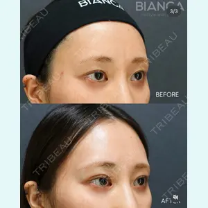 BIANCA銀座 南 寿美医師の症例