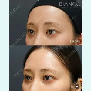 BIANCA銀座 南 寿美医師の症例