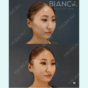 BIANCA銀座 南 寿美医師の症例