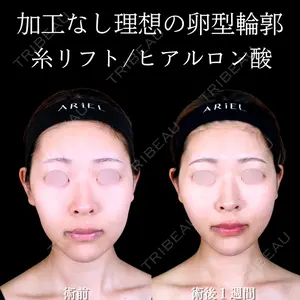 アリエル美容クリニック 大宮院 江郷隼一郎医師の症例