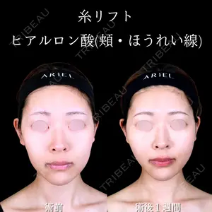 アリエル美容クリニック 大宮院 江郷隼一郎医師の症例