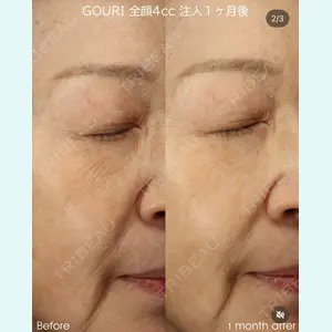 BIANCA銀座 明石 仙姫医師の症例