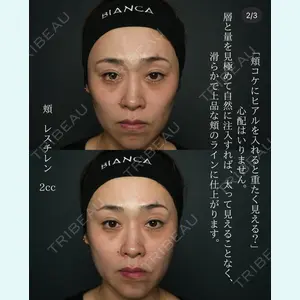 BIANCA銀座 明石 仙姫医師の症例
