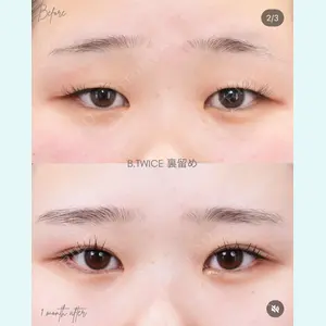 BIANCA銀座 明石 仙姫医師の症例