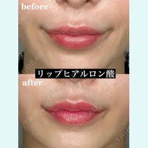 症例