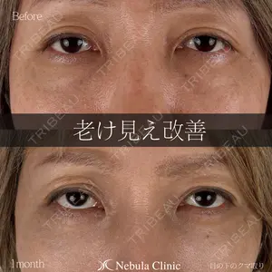 症例
