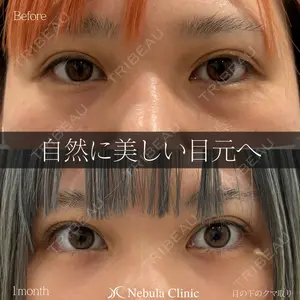 症例