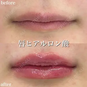 症例
