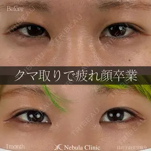 症例