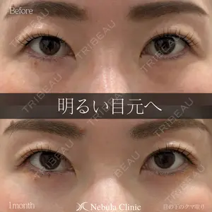 症例