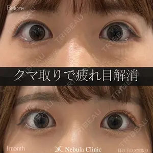 症例