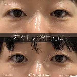 症例