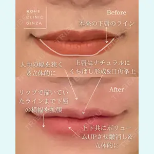 ROHE CLINIC GINZAの症例