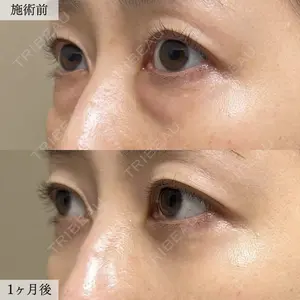 TCB東京中央美容外科 郡山院の症例