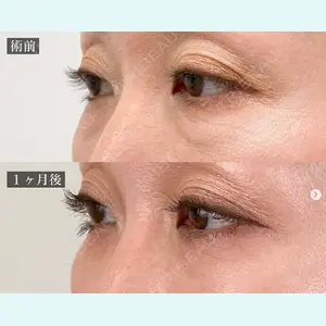 TCB東京中央美容外科 川口院の症例