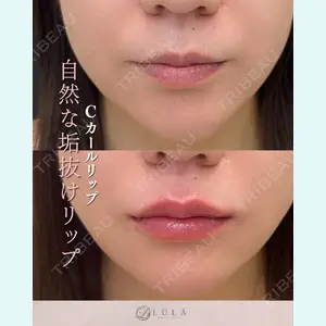 症例
