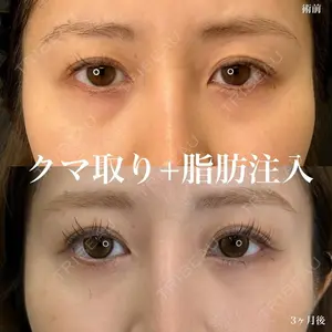 症例