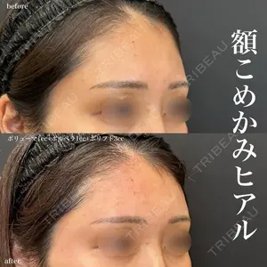 症例