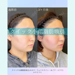 ルラ美容クリニック 札幌院 佐藤 雄紀医師の症例