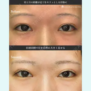 シンデレラ＆ダヴィンチクリニック 宮田 洋佑医師の症例