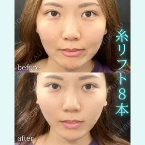 THE FIRST CLINIC 町田院 木暮 啓一郎医師の症例