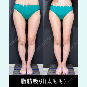 症例