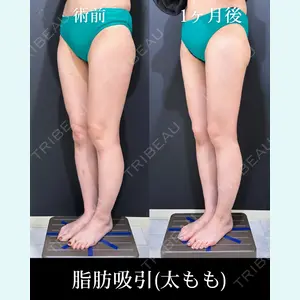 症例