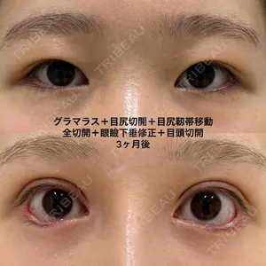 エターナル美容クリニック 久門田 詳医師の症例